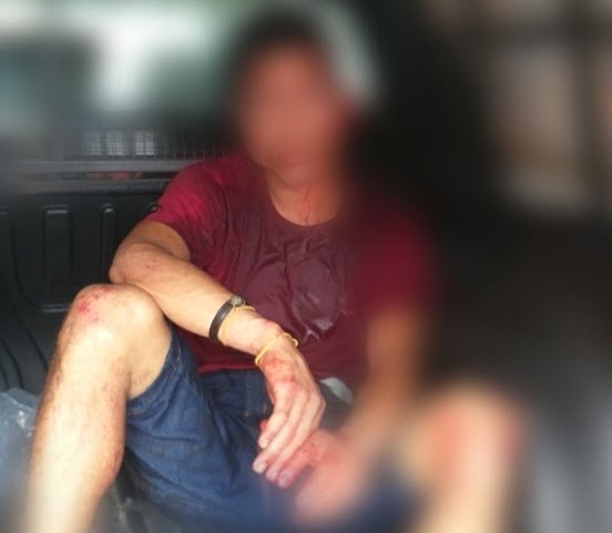 Acusado de cometer vários assaltos na rua Lobo D’almada, no Centro de Manaus, Victor de Melo Feitosa acabou agredido por populares nessa quarta-feira (19)