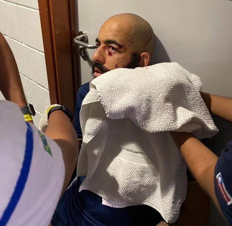 Um ataque a bomba contra o ônibus da delegação do Bahia, na noite dessa quinta-feira (24), deixou vários jogadores feridos. O time chegava à Arena Fonte Nova, em Salvador, para a partida contra o Sampaio Corrêa quando o artefato explodiu