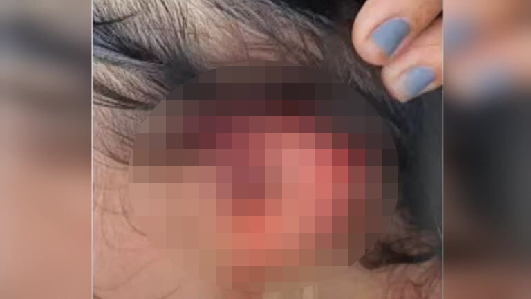 Francisco Paiva, de 45 anos, espancou e desferiu dois golpes de faca contra a companheira, ainda não identificada, na noite de quarta-feira (2). Segundo policiais militares que atenderam a ocorrência, o agressor cortou da orelha decepada da mulher durante a briga