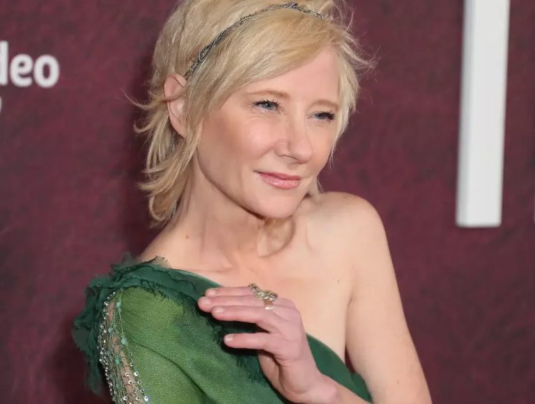 Atriz Anne Heche está em estado "extremamente crítico" após acidente de carro