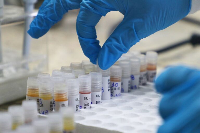 FVS atualiza situação de Covid e Monkeypox no AM