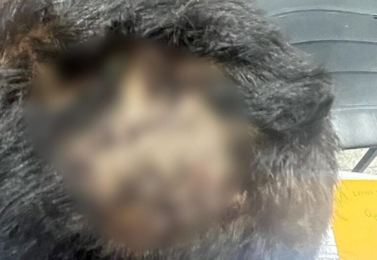 Criança de 6 anos tem cabeça quebrada por beber mingau da irmã em Manaus