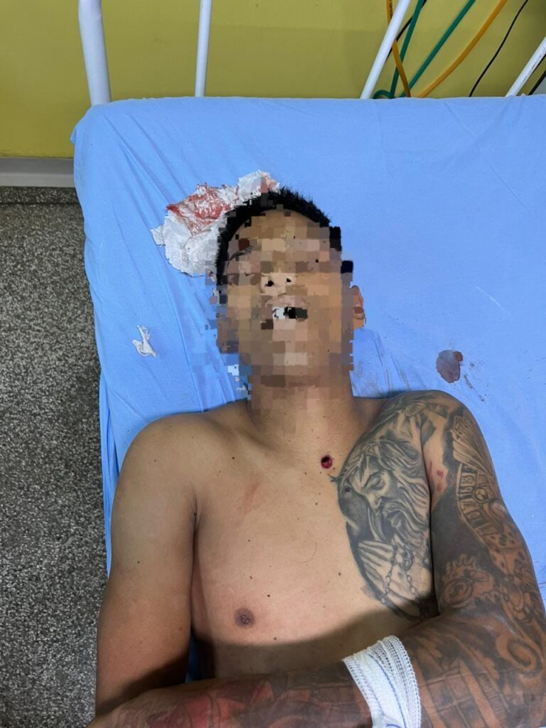 Morre suspeito de assassinar PM em Manaus