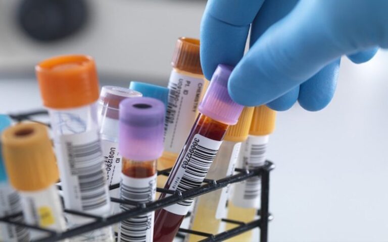 Anvisa autoriza realização de exame de análise clínica em farmácias Anvisa autoriza realização de exame de análise clínica em farmácias
