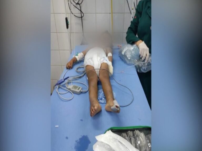 Criança é agredida e queimada pelo próprio pai no interior do AM