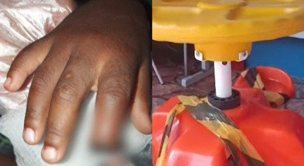 Criança perde parte do dedo em brinquedo de creche
