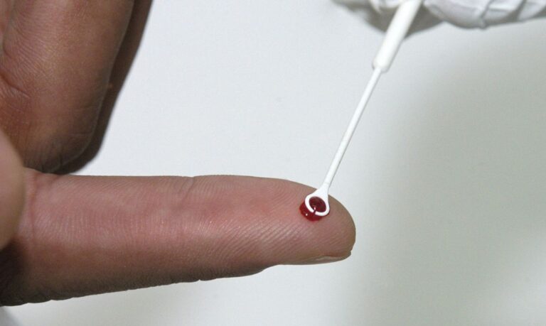 PrEP: Tratamento preventivo é alternativa no combate ao HIV no Brasil. Entenda