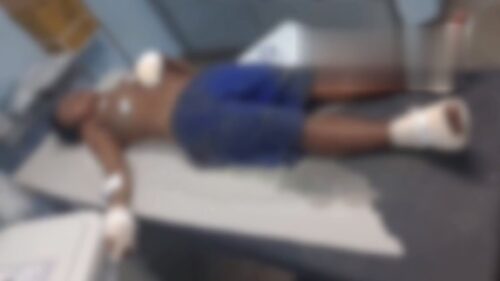 VÍDEO: “Tribunal do Crime” castiga suspeito de assaltos com tiros nos pés e mãos, em Manaus