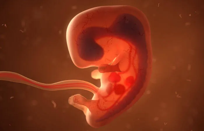Aborto legal