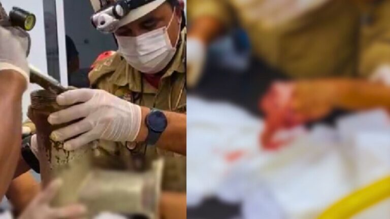 VÍDEO: Funcionário perde a mão ‘triturada’ em máquina de moer carne, em Manaus