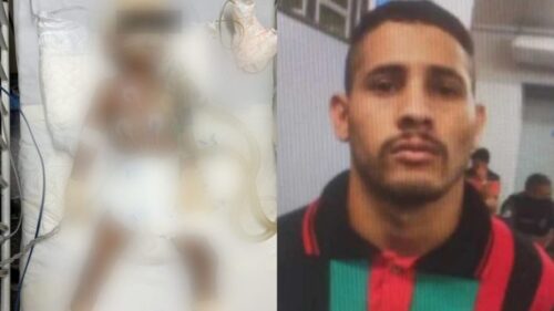 Criança torturada pelo tio morre após 6 dias internada na UTI, em Manaus