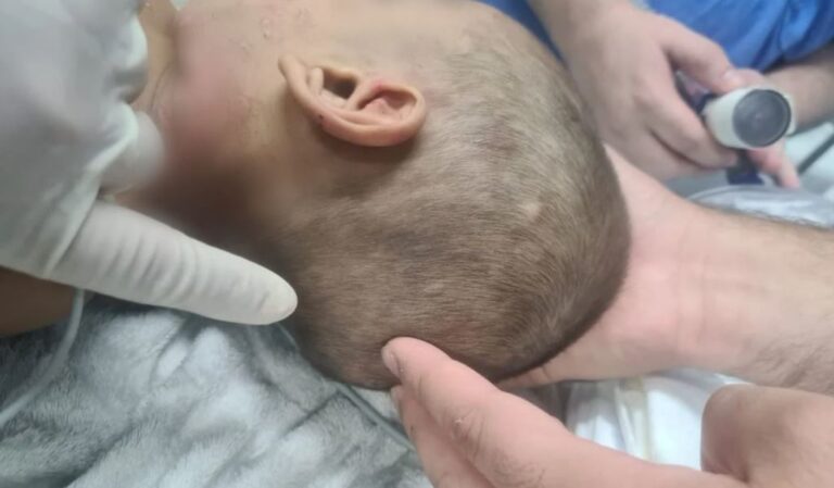 Tia é presa suspeita de ser conivente na morte e tortura de sobrinho de 2 anos, em Manaus