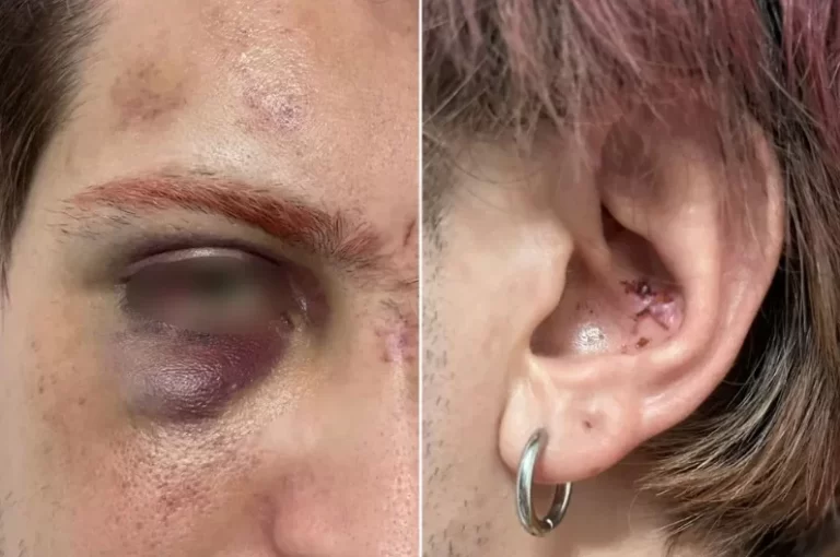 Imagem colorida mostra agressão