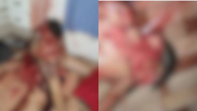 ‘Loirinho’ é executado com mais de 30 tiros de fuzil e tem rosto desfigurado, no AM
