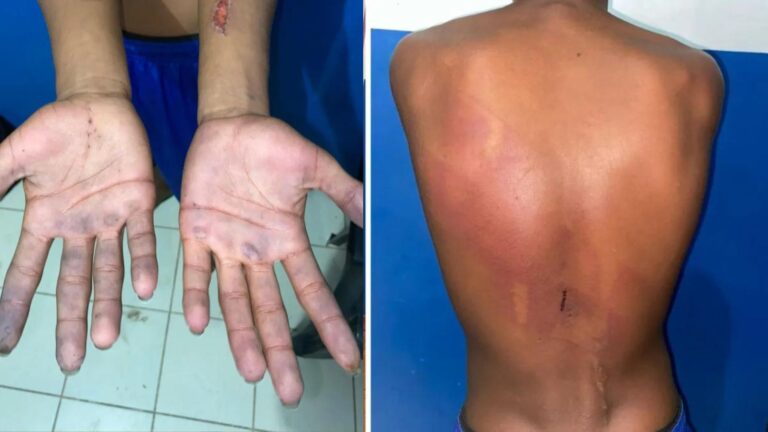 Adolescente é salvo do “tribunal do crime” após ter sido “condenado” por roubo de botijão, no Pará