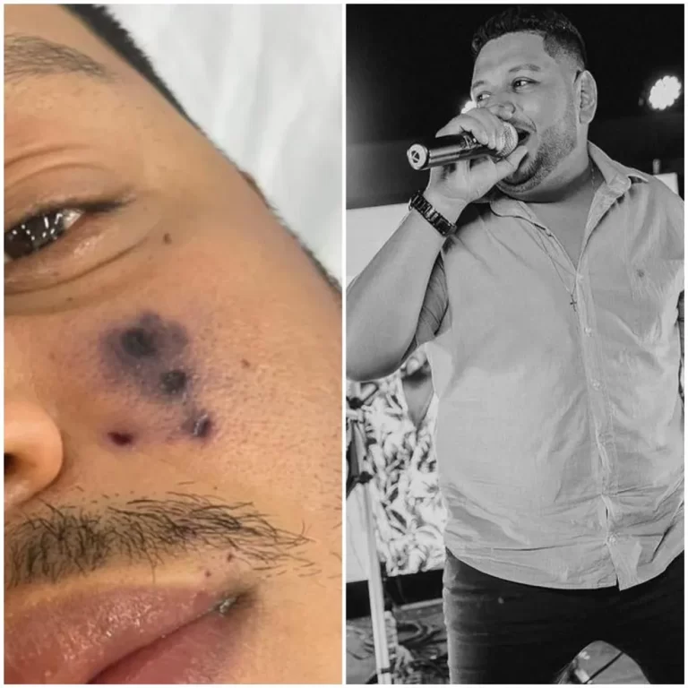 Cantor de forró morre após ser picado por aranha, em Palmas