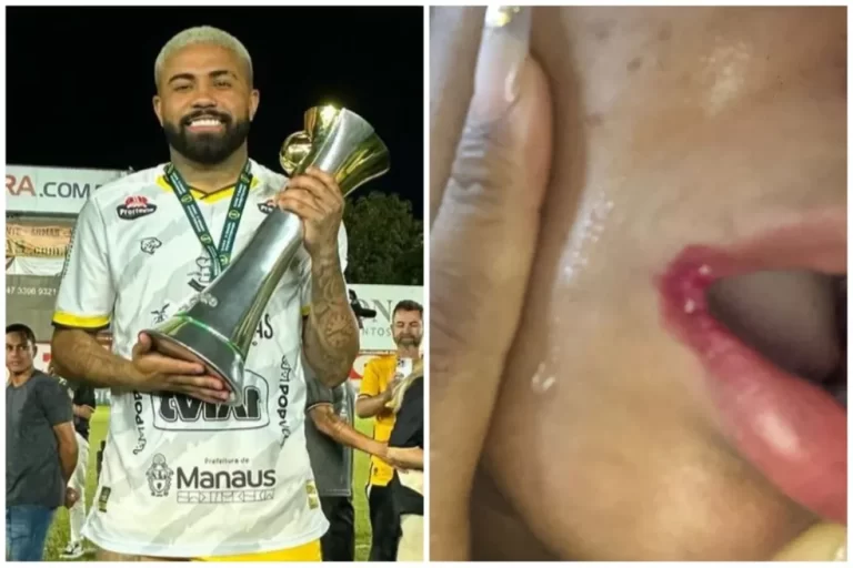 Ex-jogador do Amazonas FC é acusado de arrancar cabelos e unhas de mulher em “festinha”, no Pará