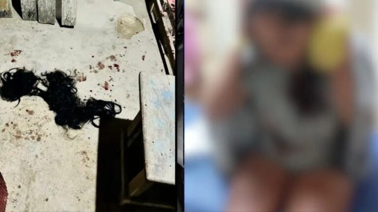 Mulher é esfaqueada, tem cabelos cortados e dedo decepado pelo ex-companheiro, no PA