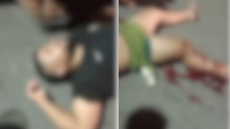 VÍDEO: Homem fica jogado ao chão com a perna supostamente quebrada após acidente, em Manaus