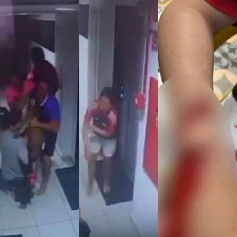 VÍDEO: Pitbull ataca criança ao fugir de apartamento em Maceió
