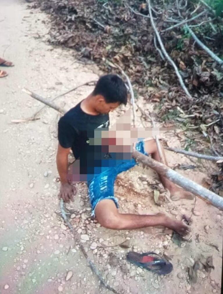 Jovem fica com tronco atravessado no peito após acidente de moto, no norte do Tocantins