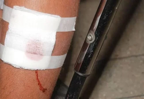 Homem atira em vizinho ao ser chamado de ‘corno’ durante confusão por sumiço de ‘makita’, em Manaus