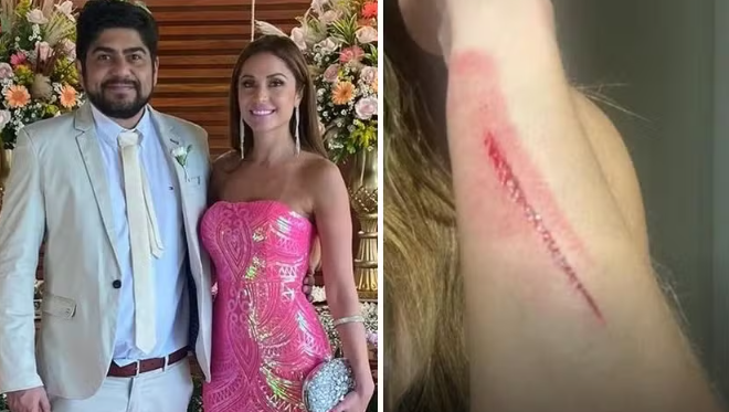 Campeã do BBB 11, Maria Melilo denuncia namorado por agressão