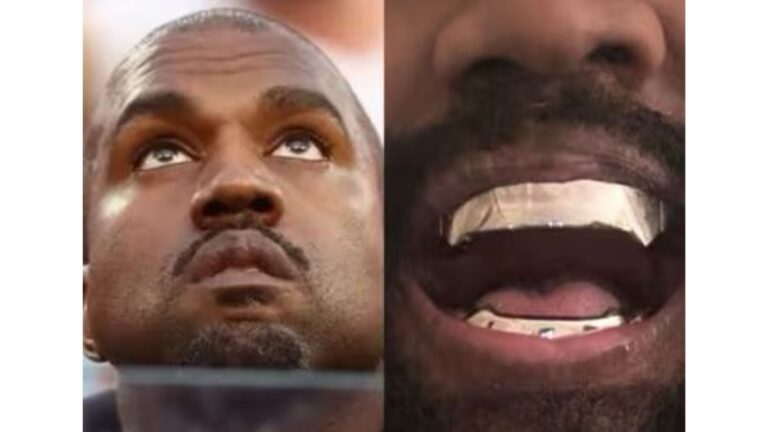 Kanye West coloca prótese de titânio de R$ 4 milhões nos dentes; veja como ficou