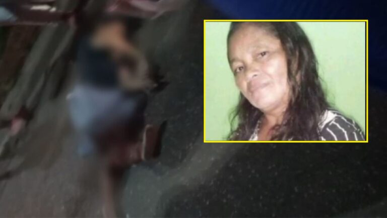 VÍDEOS: Morre mulher atropelada que ficou com ossos expostos, no AM