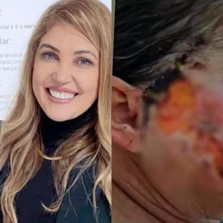 Dentista é presa suspeita de deformar rostos de pacientes em Goiânia