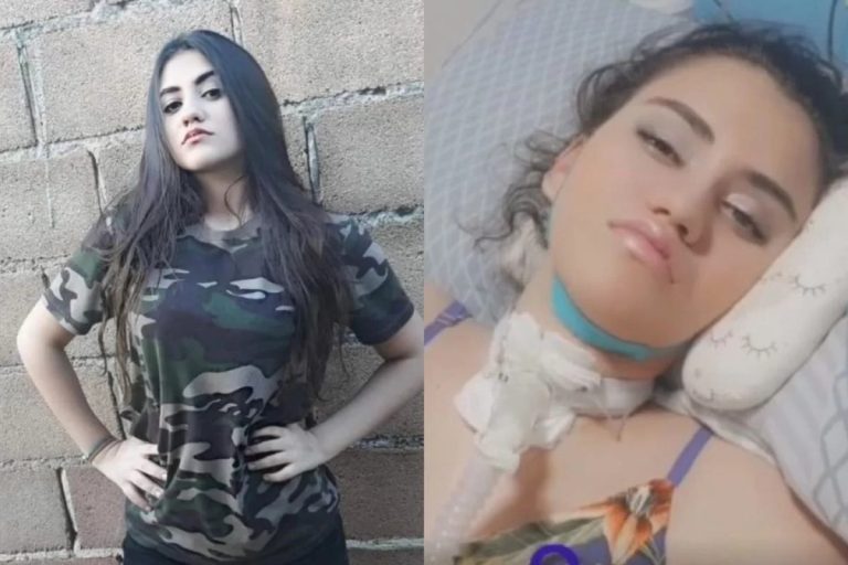 Jovem contrai caso raro de dengue neurológica e fica tetraplégica e cega