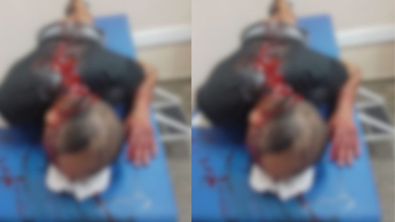 Homem leva golpes de terçado na cabeça após disparar tiros em bar de Manaus