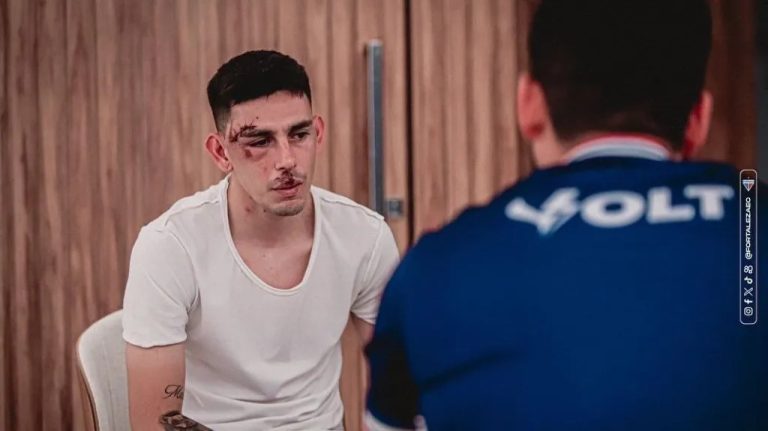 Jogador do Fortaleza mostra rosto machucado após ataque a ônibus; time chama ato de "terrorismo"