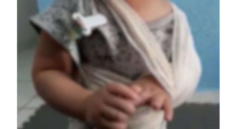 Pais são investigados por tortura de bebê de 1 ano que teve clavícula quebrada e pés queimados, em Manaus Pais são investigados por tortura de bebê de 1 ano que teve clavícula quebrada e pés queimados, em Manaus