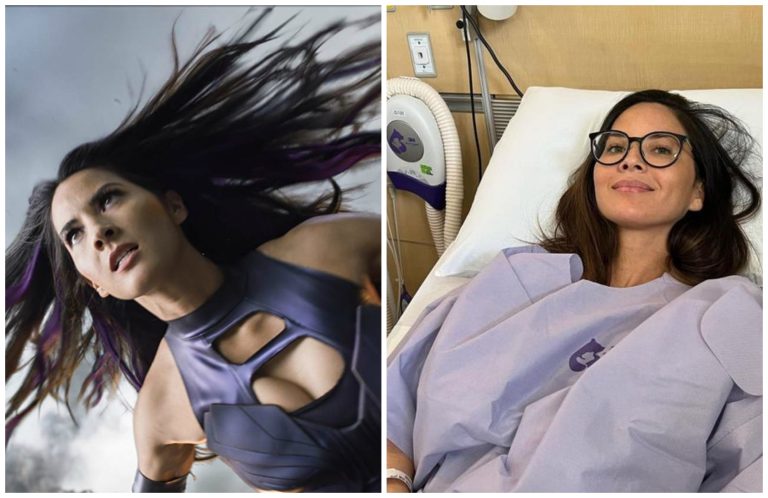 Atriz de ‘X-Men: Apocalipse’ revela diagnóstico de câncer agressivo de mama
