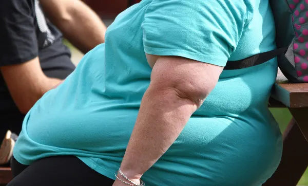 Uma em cada oito pessoas no mundo é obesa, alerta OMS