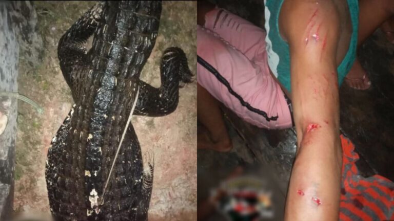 Em Manicoré-AM, homem tem braço mordido em ataque de jacaré; veja fotos