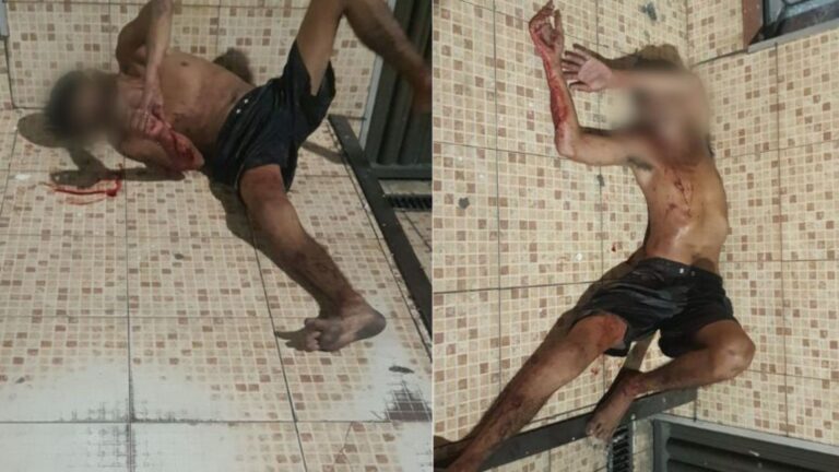 Em Manaus, homem é espancado e abandonado na rua em condições misteriosas