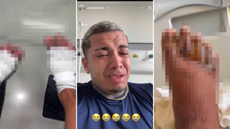Influenciadores têm queimaduras após ficarem com pés imersos em gelo em reality no Recife