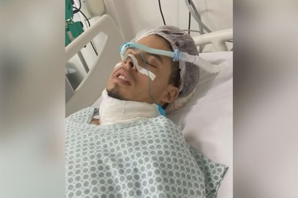 Homem passa 4 dias em UTI após extrair siso com aluna de Odontologia da UNESP