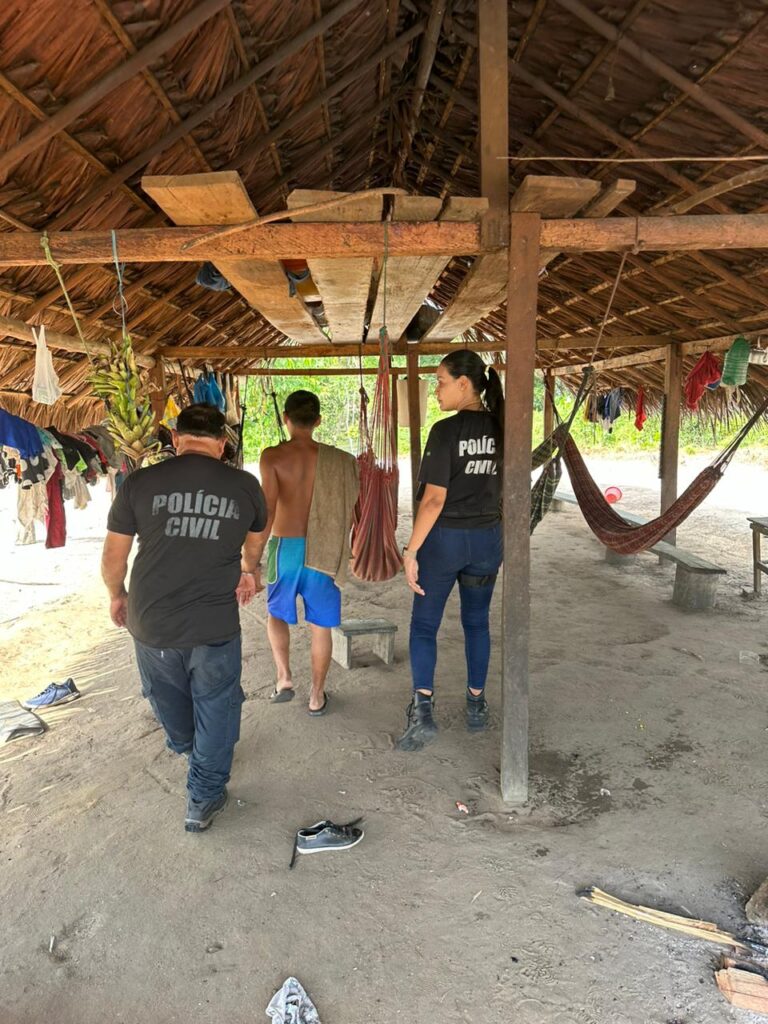 Bebê indígena de 9 meses tem o crânio exposto ao ser agredida por tio, no AM