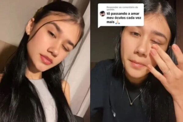 VÍDEO: Jovem fica cega parcialmente após mau uso de lentes de contato, em SC