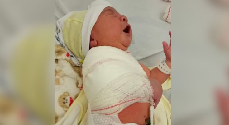 Bebê tem clavícula fraturada durante parto em São Vicente (SP)