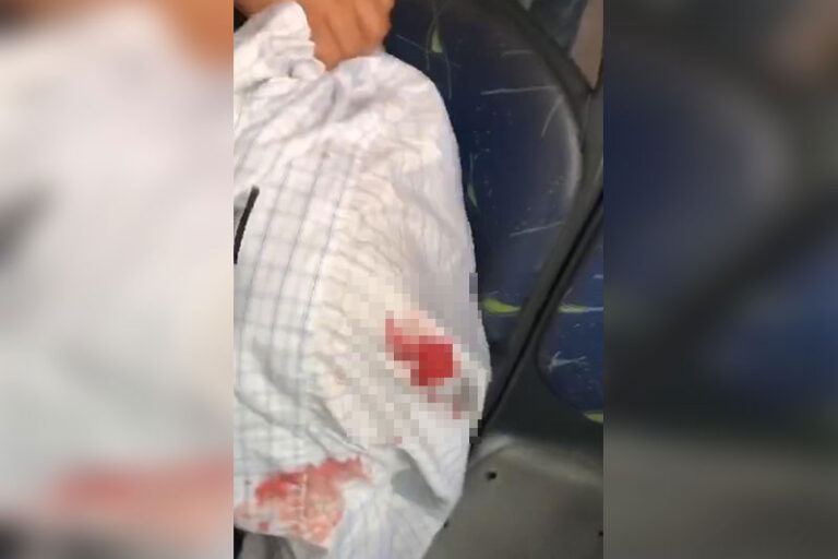 Criminosos tocam terror na linha 560 em Manaus; passageiro é esfaqueado