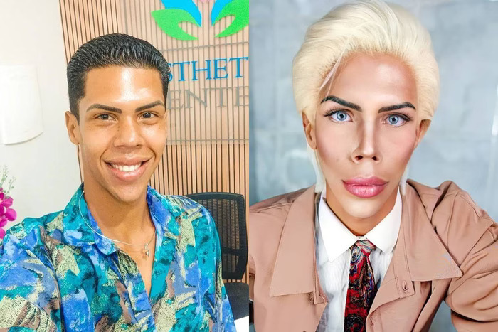 SP: “Ken Humano” desiste de customização e tenta nova vida como frentista