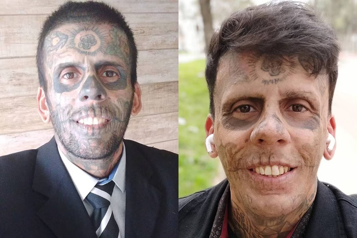 SP: "Homem mais tatuado do Brasil" se converte e começa a apagar tatuagens do rosto