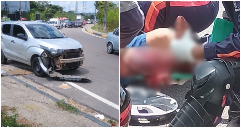 VÍDEO: Motociclista tem perna dilacerada em grave acidente na Av. das Torres