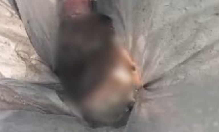 VÍDEO: Cabeça humana é encontrada dentro de saco de lixo no bairro Educandos
