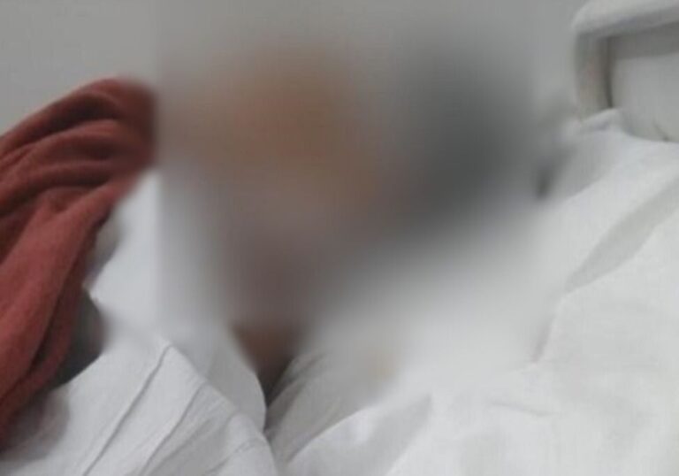 Adolescente tem dedos decepados por facção criminosa em Manaus