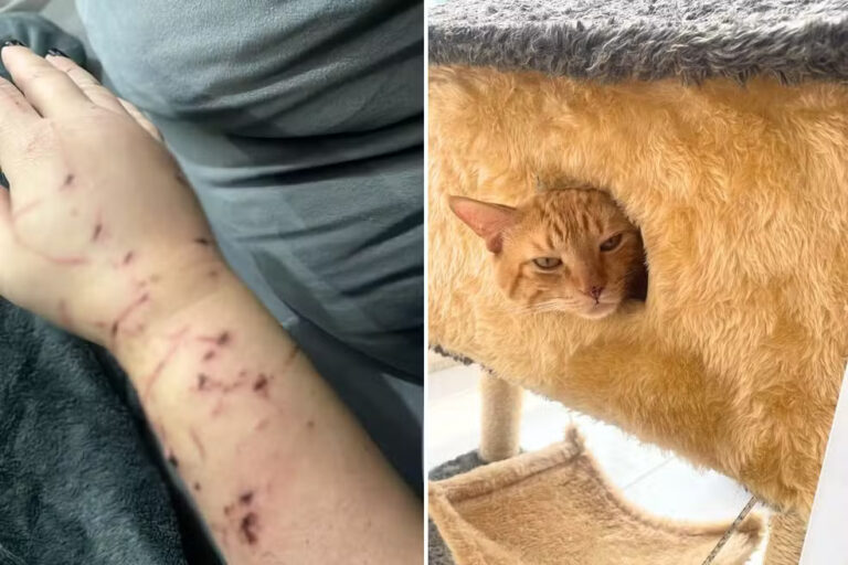 SP: Gato dilacera braço de tutora e faz família de "refém" dentro da própria casa